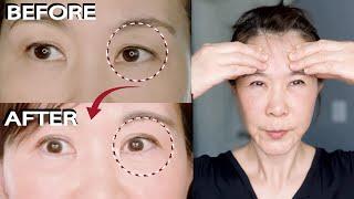 LIFT SAGGING EYE LIDS AND SMOOTH OUT UNDER EYE BAGS NATURALLY AT HOME. FAST RESULT!