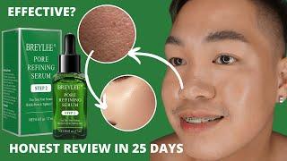 BREYLEE PORE REFINING SERUM HONEST REVIEW IN 25 DAYS! NAKAKALIIT NGA BA NG PORES?!