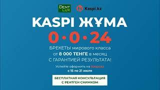 В Dent-lux РАССРОЧКА НА 24 МЕСЯЦА от Kaspi.kz на БРЕКЕТЫ!