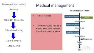 Kozhikode Ophthalmic Society Webinar on " Scleritis"