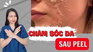 Sau khi peel da nên dùng sản phẩm gì? Chăm sóc da sau peel | Nguyễn Mai Hương