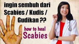 Cara mengobati Scabies / Kudis / Gudikan // How to heal Scabies