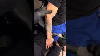 First Laser Session Tattoo Removal on Large Angel on Forearm