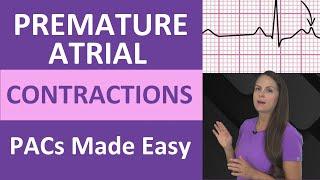 Premature Atrial Contractions PACs Nursing NCLEX Review, Mnemonics | ECG interpretation