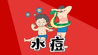 医学记忆漫画 | 【水痘】和【带状疱疹】