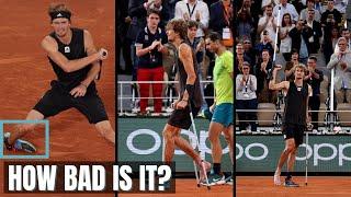 Expert Explains Alex Sverev Ankle Injury & Return Timeline Scenarios