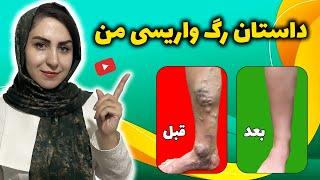 درمان رگ های واریسی بدون عمل جراحی | تورم اعصاب | کاهش وزن | سوالات شما