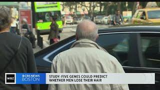 Male pattern baldness could be connected to rare genetic variants, study finds