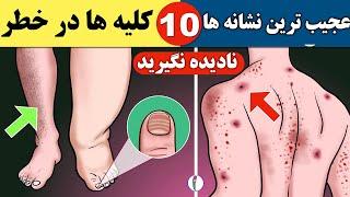 ️۱۲ علامت هشدار دهنده سمی بودن کلیه ها | بیماری مزمن کلیه|  سلامت کلیه CKD