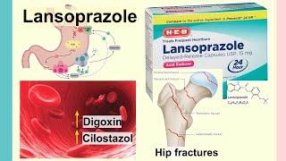 lansoprazole