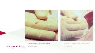 SURGICEL® FIBRILLAR™ vs SURGICEL® Original Hemostatic Efficacy Study