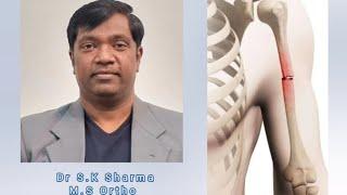 journey of a fracture #Dr S.K Sharma M.S Ortho #Surya Orthopedic and spinal centre