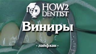 Как фиксировать виниры, лайфхаки / How to Dentist