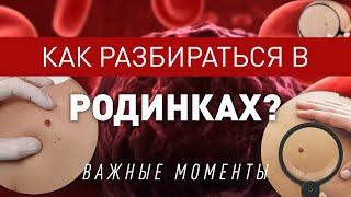 Родинки или Меланома, как разобраться самостоятельно?