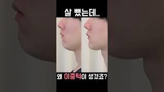 살뺐는데 왜 이중턱이 생겼지? #shorts #성형없이예뻐지기 #K뷰티 #얼굴교정 #얼굴비대칭 #작은얼굴 #뷰티팁 #땅콩형얼굴 #안면비대칭 #이중턱