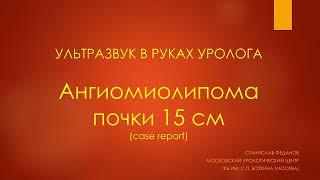 Ультразвук в руках уролога. Ангиомиолипома почки 15 см.