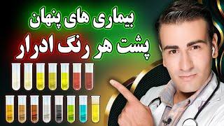 هر رنگ ادرار نشانه چه بیماری هایی است؟ | What Diseases Does Each Color of Urine Indicate?