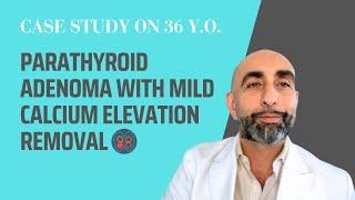 Parathyroid adenoma with mild Calcium elevation | HPT case study