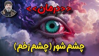 ️چشم شور و درمان چشم زخم ️| راه‌های رفع انرژی منفی – شیخ کاوه