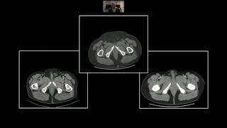 Colonic Emergencies | Interesting Radiology Cases