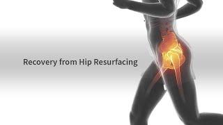 Recovery from Hip Resurfacing