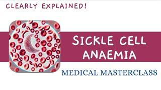 SICKLE CELL ANAEMIA LECTURE BY MEDICAL MASTERCLASS