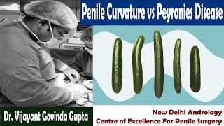 Curved Penis Causes - Penile Curvature vs Peyronies Disease