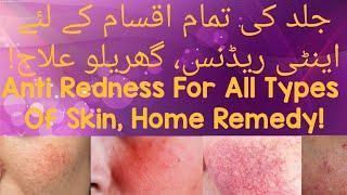 (جلد کی تمام اقسام کے لئے اینٹی ریڈنس، گھریلو علاج) Anti Redness For All Types Of Skin, Home Remedy|