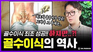 병원에서 골수이식을 받은 환자들이 100% 사망했던 이유 | 의학의 역사 골수 이식 편