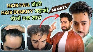 100% HAIRFALL रुकेगा और HAIR DENSITY DOUBLE हो जाएगी | ULTIMATE MEN'S HAIR CARE ROUTINE