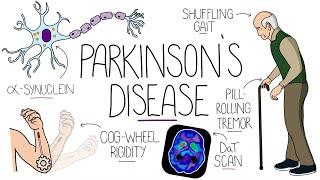 Understanding Parkinson's Disease (Including Direct and Indirect Pathways)