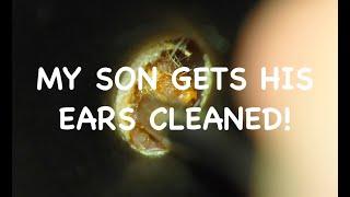 EAR WAX REMOVAL : MY SON WANTED HIS EARS CLEANED : HILARIOUS REACTION