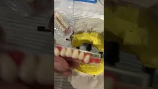 Partial denture setup #umairtoothfairy #dentist #umairazeem #shorts @Umairazeem8553