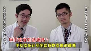 臺大醫院甲狀腺穿刺Q&A