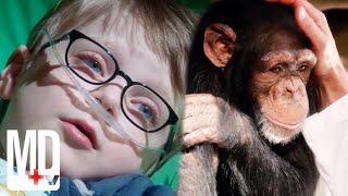 Doctors Transplant a Little Boy’s Heart into a Chimpanzee | Heartbeat | MD TV