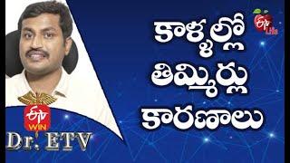 Numbness In The Legs - Causes | కాళ్ళల్లో తిమ్మిర్లు - కారణాలు| Dr.ETV | 24th April 2021| ETV Life