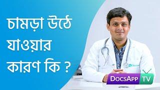 চামড়া উঠে যাওয়ার কারণ কি ? #AsktheDoctor