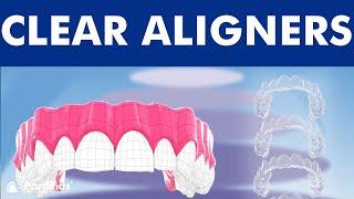 INVISALIGN - Orthodontic treatment with CLEAR ALIGNERS ©