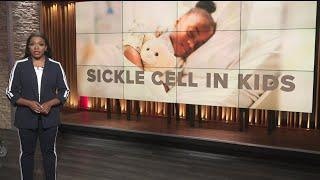 CDC issues warning about sickle cell disease in kids