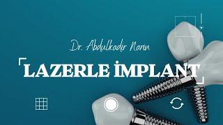 Lazerle İmplant Nedir?