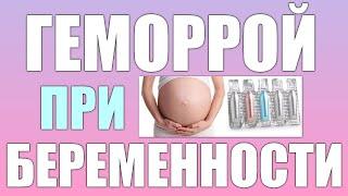 Геморрой во время беременности.Профилактика и лечение геморроя