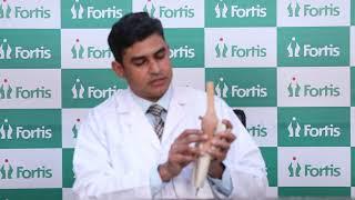 Knee Arthritis, Dr Vinay Kumaraswamy | Fortis Hospital, Rajajinagar