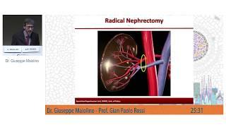 Drug Resistant Hypertension: An Intriguing Case