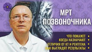 МРТ позвоночника - когда назначает врач, показания к проведению. Отличие от КТ.