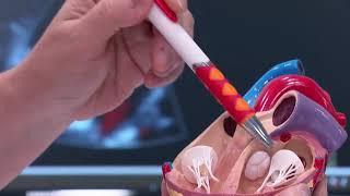 AHVC (Asian Heart and Vascular Centre) CNA Health Seminar Trailer