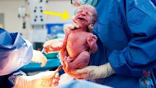 Mother Gives Birth to STRANGE BABY and Doctor Makes Shocking Discovery!