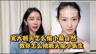 额头又宽又大怎么缩小最自然 教你如何挑选额头缩小的医生