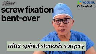 After spinal surgery became bent over, re operation possible/Wooridul Spine Hospital