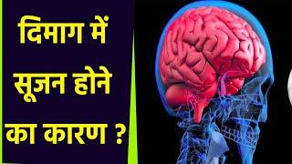 दिमाग में सूजन क्यों हो जाती है। दिमाग में सूजन होने का कारण। दिमाग में सूजन होने का इलाज। Boldsky