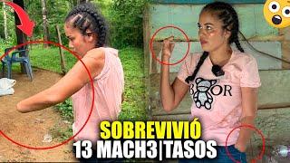 ELLA SOBREVIVIÓ A VARIOS MACHETASOS POR SU EX PAREJA  QUEDO SIN MANOS  EPISODIO 1/2